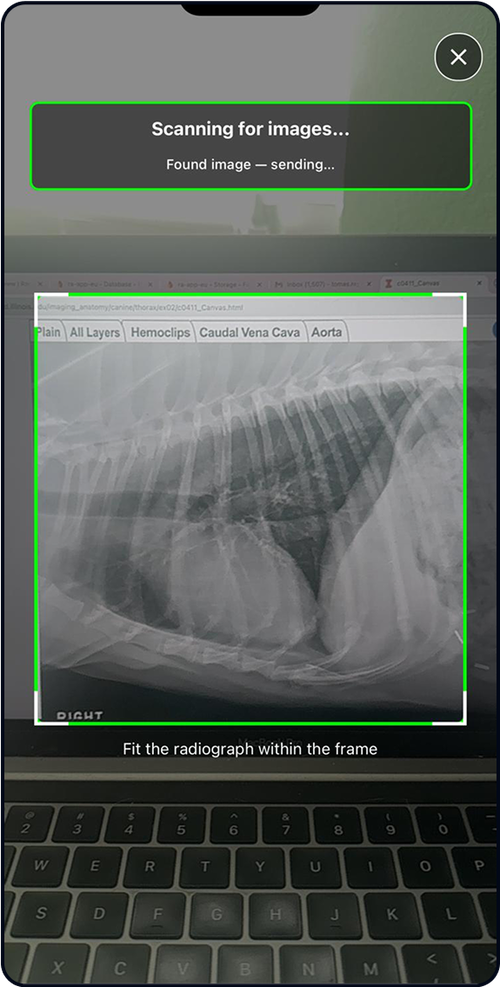 Capture the Radiograph