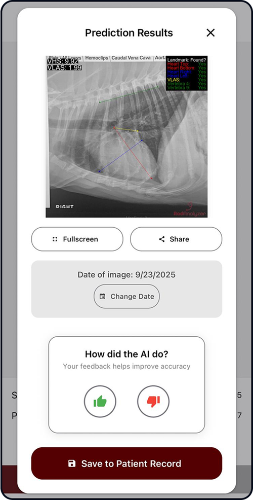 AI Calculates VHS & VLAS